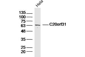 Hela lysates probed with C20orf31 Polyclonal Antibody, Unconjugated  at 1:300 dilution and 4˚C overnight incubation. (EDEM2 抗体  (AA 101-200))