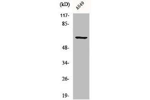 Western Blot analysis of A549 cells using CLIP3 Polyclonal Antibody (CLIP3 抗体  (Internal Region))