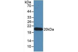 Detection of Recombinant IL17, Human using Monoclonal Antibody to Interleukin 17 (IL17) (IL-17 抗体  (AA 20-155))