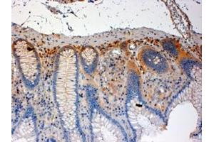 ABIN184606 (4µg/ml) staining of paraffin embedded Human Colon. (CSK 抗体  (C-Term))