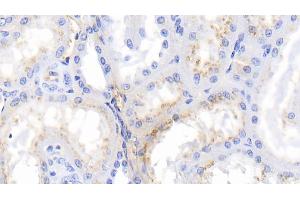Immunohistochemistry (IHC) image for anti-Fibrinogen alpha Chain (FGA) (AA 39-615) antibody (ABIN7443677)