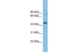 WB Suggested Anti-CCBE1 Antibody Titration: 0. (CCBE1 抗体  (Middle Region))
