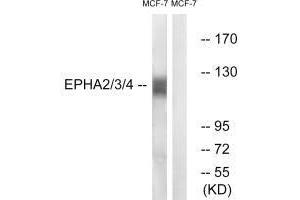 Western blot analysis of extracts from MCF7 cells, using EPHA2/3/4 (Ab-588/596) antibody. (EPH Receptor A2 抗体  (Tyr588, Tyr596))
