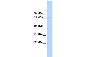 WB Suggested Anti-PAntibody Titration:  0. (PARP6 抗体  (N-Term))
