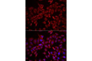 Immunofluorescence analysis of HeLa cell using CSRP3 antibody. (CSRP3 抗体)