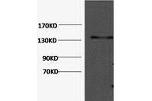 Western Blotting (WB) image for anti-Collagen, Type III, alpha 1 (COL3A1) antibody (ABIN7250170)