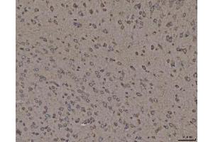 IHC analysis of Calnexin/CANX using anti-Calnexin/CANX antibody (ABIN7602289). (Calnexin 抗体  (AA 68-582))