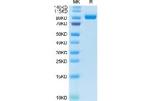 Cynomolgus FAP on Tris-Bis PAGE under reduced condition. (FAP Protein (AA 26-760) (His tag))