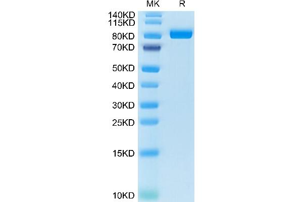 FAP Protein (AA 26-760) (His tag)