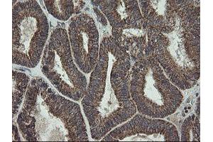 Image no. 2 for anti-Family with Sequence Similarity 164, Member A (FAM164A) antibody (ABIN1498198) (FAM164A 抗体)