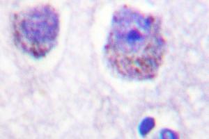 Image no. 1 for anti-Ribosomal Protein S6 Kinase, 70kDa, Polypeptide 1 (RPS6KB1) antibody (ABIN272052) (RPS6KB1 抗体)