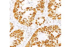 IHC staining of normal colon with p53 antibody cocktail (BP53-12 + DO-7).