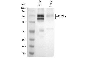 Western blot analysis of IL17RA using anti-IL17RA antibody (ABIN5518928).