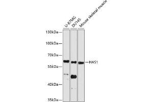 Western blot analysis of extracts of various cell lines, using H antibody (ABIN6129577, ABIN6141611, ABIN6141612 and ABIN6214712) at 1:1000 dilution. (HAS1 抗体  (AA 80-390))