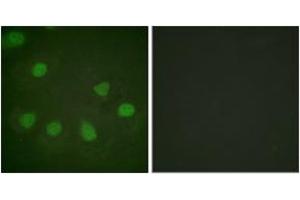 Immunofluorescence analysis of HeLa cells, using Retinoblastoma (Ab-249) Antibody.