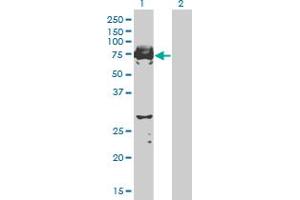 Western Blot analysis of C9orf96 expression in transfected 293T cell line by C9orf96 monoclonal antibody (M03), clone 2B5. (C9orf96 抗体  (AA 1-99))