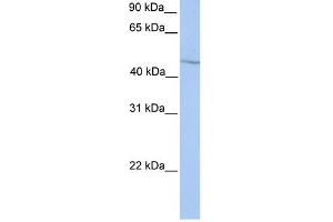 WB Suggested Anti-HOXA13 Antibody Titration: 0. (HOXA13 抗体  (Middle Region))