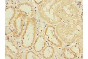 Immunohistochemistry of paraffin-embedded human kidney tissue using ABIN7152192 at dilution of 1:100 (EIF4E2 抗体  (AA 1-240))