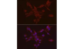 Immunofluorescence analysis of PC-12 using S100 antibody (ABIN7270123) at dilution of 1:25 (40x lens). (S100A10 抗体  (AA 1-97))