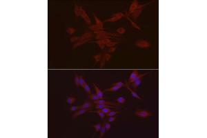 Immunofluorescence analysis of PC-12 using S100 antibody (ABIN7270123) at dilution of 1:25 (40x lens). (S100A10 抗体  (AA 1-97))
