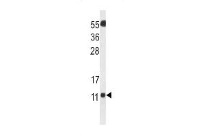 Western blot analysis of SH3BGRL3 Antibody in Neuro2a cell line lysates (35ug/lane) (SH3BGRL3 抗体  (AA 24-52))