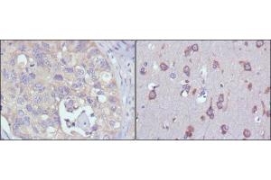 Immunohistochemical analysis of paraffin-embedded human lung cancer (left) and human brain (right) tissues using MPS1 mouse mAb with DAB staining. (Mps1 抗体)