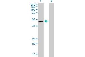 Western Blot analysis of RECQL5 expression in transfected 293T cell line by RECQL5 MaxPab polyclonal antibody. (RECQL5 抗体  (AA 1-435))