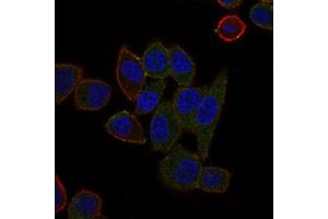 Immunohistochemistry (IHC) image for anti-ATP-Binding Cassette, Sub-Family B (MDR/TAP), Member 5 (ABCB5) (AA 481-674) antibody (ABIN1842667)