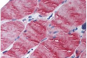 Human Skeletal Muscle (formalin-fixed, paraffin-embedded) stained with MYO5B antibody ABIN305726 at 2. (MYO5B 抗体  (N-Term))