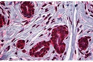 Human Breast: Formalin-Fixed, Paraffin-Embedded (FFPE) (MDM2 抗体  (AA 101-201))