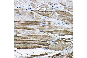 Immunohistochemistry of paraffin-embedded mouse stomach using LDB3 Rabbit pAb (ABIN6128179, ABIN6143125, ABIN6143126 and ABIN6223347) at dilution of 1:200 (40x lens).