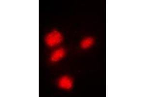 Immunofluorescent analysis of CREB staining in Hela cells. (CREB1 抗体  (Center))