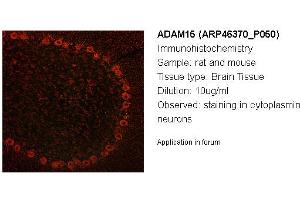 Image no. 2 for anti-ADAM Metallopeptidase Domain 15 (ADAM15) (Middle Region) antibody (ABIN405816) (ADAM15 抗体  (Middle Region))