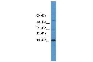WB Suggested Anti-HMGA1  Antibody Titration: 0. (HMGA1 抗体  (N-Term))