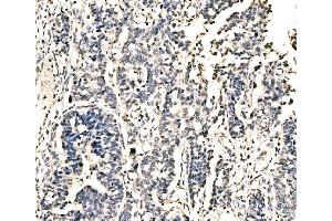 IHC analysis of KI/VIRMA using anti-KI/VIRMA antibody (ABIN7599707). (Protein Virilizer Homolog (VIRMA) (AA 11-1529) 抗体)