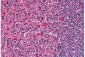 Human Tonsil: Formalin-Fixed, Paraffin-Embedded (FFPE) (DNASE1 抗体  (AA 1-252))
