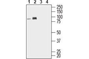 Western Blotting (WB) image for anti-Ectonucleoside Triphosphate diphosphohydrolase 1 (ENTPD1) (AA 398-411), (Extracellular) antibody (ABIN7043112)