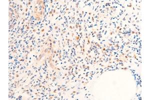 ABIN6267073 at 1/100 staining rat appendiceal tissue sections by IHC-P. (CHEK1 抗体  (pSer280))