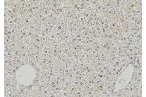 ABIN6274798 at 1/100 staining Mouse liver tissue by IHC-P.