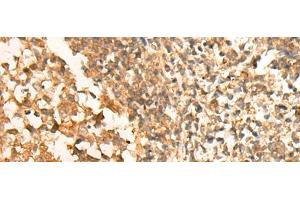 Immunohistochemistry of paraffin-embedded Human tonsil tissue using CEP57 Polyclonal Antibody at dilution of 1:30(x200) (CEP57 抗体)