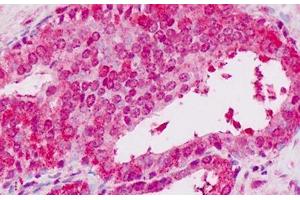 Human Prostate: Formalin-Fixed, Paraffin-Embedded (FFPE) (STAT2 抗体  (C-Term))