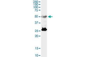 TFEB monoclonal antibody (M01), clone S1. (TFEB 抗体  (AA 1-476))