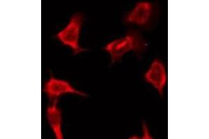 ABIN6276197 staining HeLa by IF/ICC. (OR9Q2 抗体  (C-Term))