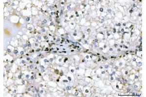 IHC analysis of GADD45B using anti-GADD45B antibody (ABIN7603219).