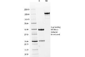 SDS-PAGE Analysis Purified RCC Mouse Monoclonal Antibody (66. (CA9 抗体)