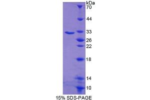 SDS-PAGE analysis of Human CTBP1 Protein. (BIP1 Protein (C-Term))