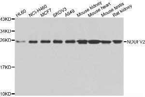Western blot analysis of extracts of various cell lines, using NDUFV2 antibody (ABIN5975536) at 1/1000 dilution. (NDUFV2 抗体)