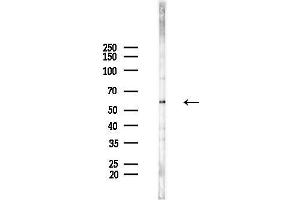 anti-Solute Carrier Family 22 Member 6 (SLC22A6) (Internal Region) antibody