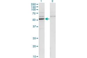 Western Blotting (WB) image for anti-Cytochrome P450, Family 26, Subfamily B, Polypeptide 1 (CYP26B1) (AA 131-230) antibody (ABIN566029)