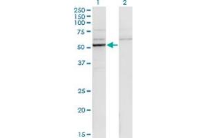 Western Blot analysis of CYP26B1 expression in transfected 293T cell line by CYP26B1 monoclonal antibody (M01), clone 1H6. (CYP26B1 抗体  (AA 131-230))